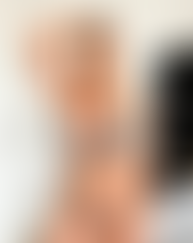 Geblurrte Content-Vorschau