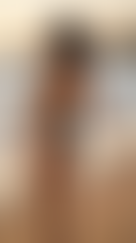 Geblurrte Content-Vorschau