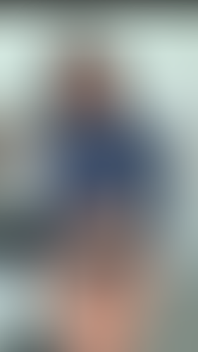 Geblurrte Content-Vorschau