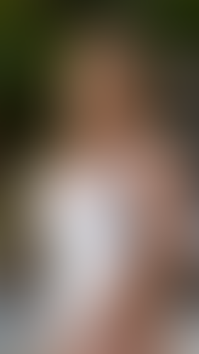 Geblurrte Content-Vorschau