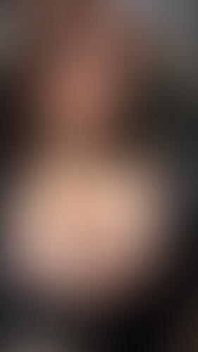 Geblurrte Content-Vorschau