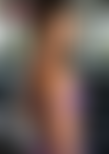 Geblurrte Content-Vorschau