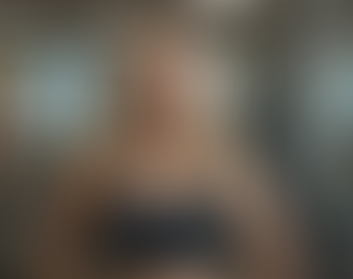 Geblurrte Content-Vorschau