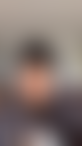 Geblurrte Content-Vorschau