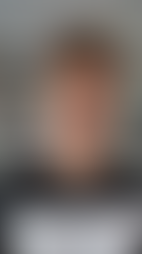 Geblurrte Content-Vorschau