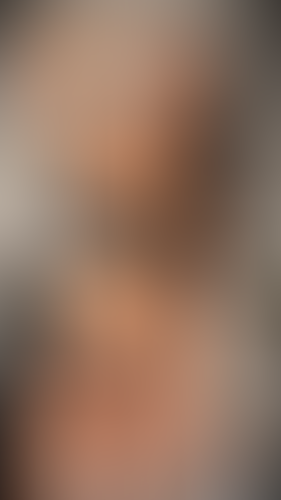 Geblurrte Content-Vorschau