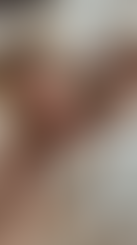 Geblurrte Content-Vorschau