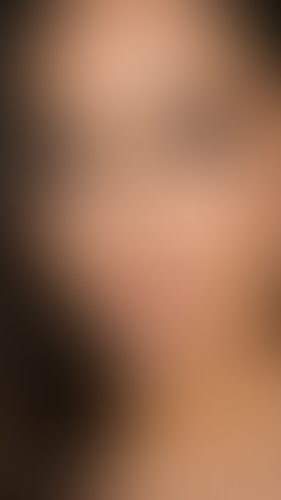 Geblurrte Content-Vorschau