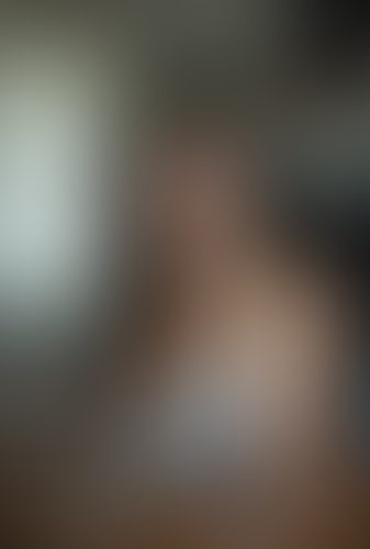 Geblurrte Content-Vorschau