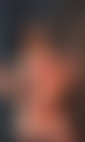 Geblurrte Content-Vorschau
