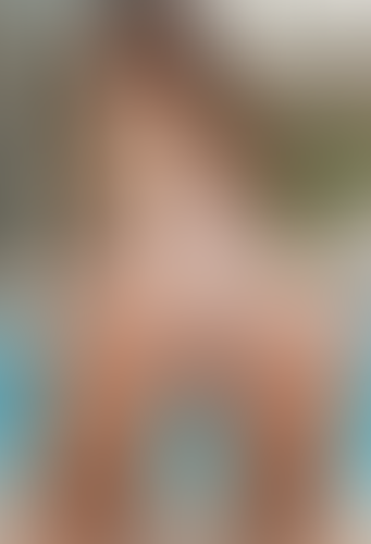 Geblurrte Content-Vorschau