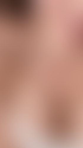 Geblurrte Content-Vorschau