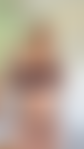 Geblurrte Content-Vorschau