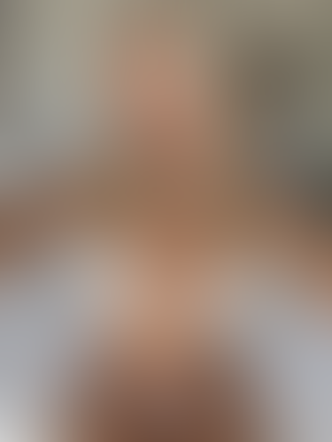Geblurrte Content-Vorschau