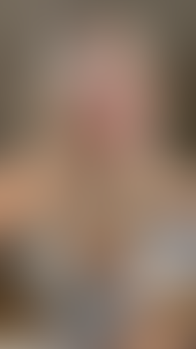 Geblurrte Content-Vorschau