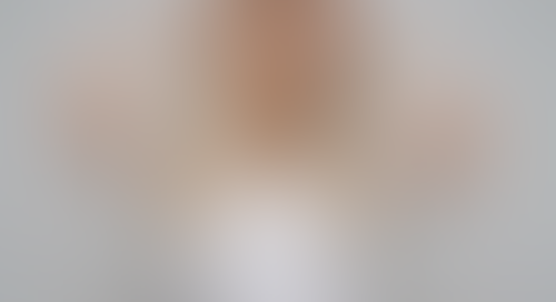Geblurrte Content-Vorschau
