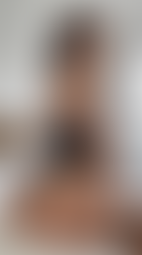 Geblurrte Content-Vorschau