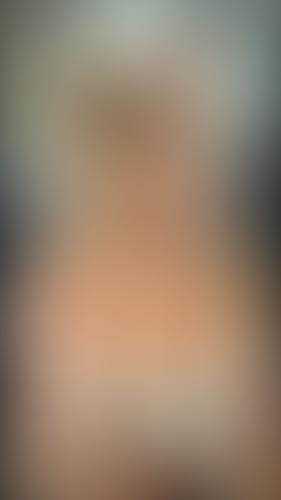 Geblurrte Content-Vorschau