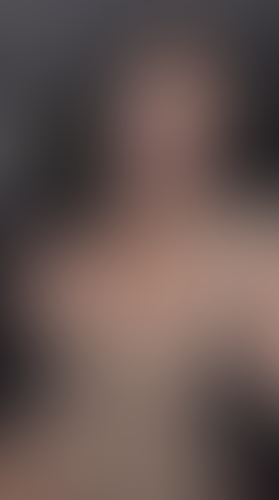 Geblurrte Content-Vorschau