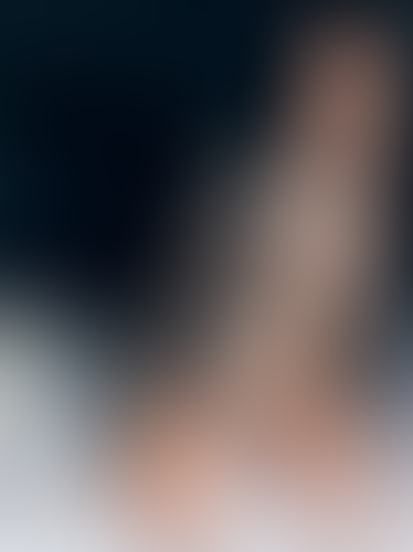 Geblurrte Content-Vorschau