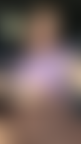 Geblurrte Content-Vorschau
