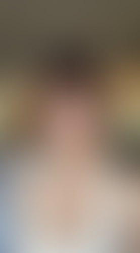Geblurrte Content-Vorschau