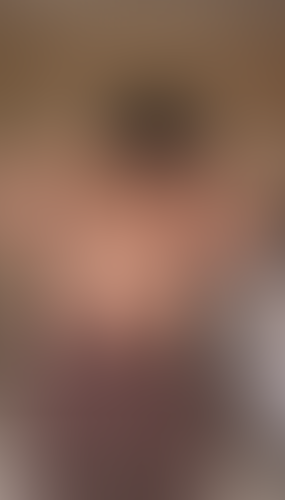 Geblurrte Content-Vorschau