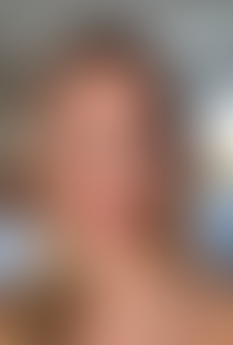 Geblurrte Content-Vorschau