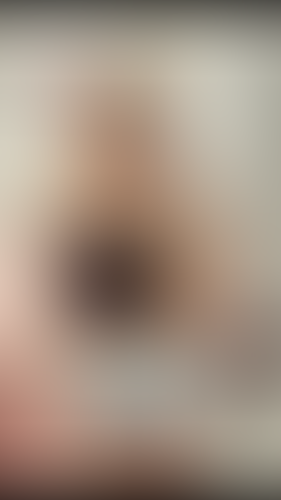 Geblurrte Content-Vorschau