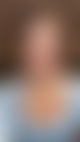 Geblurrte Content-Vorschau