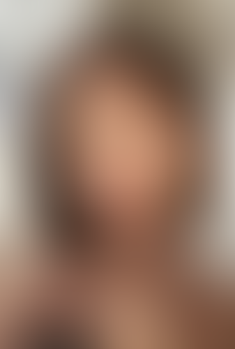 Geblurrte Content-Vorschau