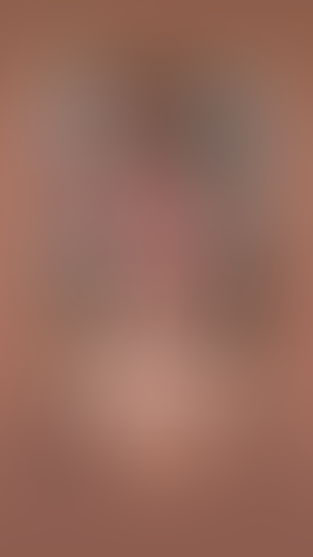 Geblurrte Content-Vorschau