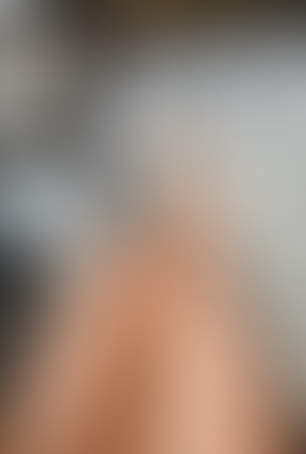 Geblurrte Content-Vorschau