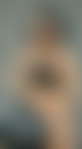 Geblurrte Content-Vorschau