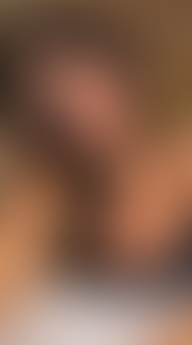Geblurrte Content-Vorschau