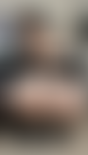 Geblurrte Content-Vorschau