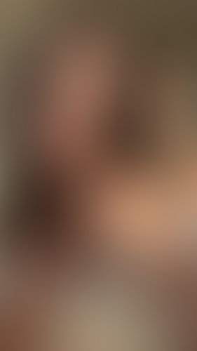 Geblurrte Content-Vorschau