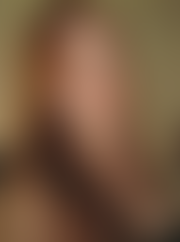 Geblurrte Content-Vorschau