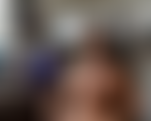 Geblurrte Content-Vorschau