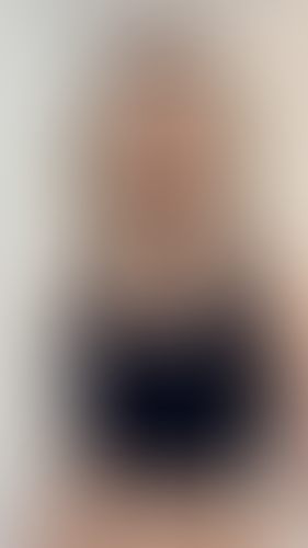 Geblurrte Content-Vorschau