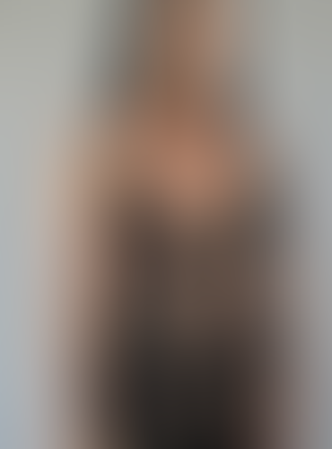 Geblurrte Content-Vorschau