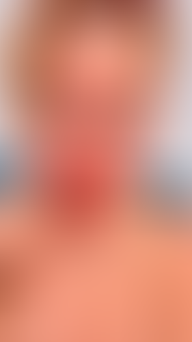 Geblurrte Content-Vorschau
