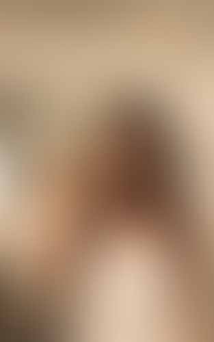 Geblurrte Content-Vorschau