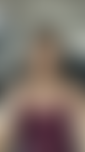 Geblurrte Content-Vorschau