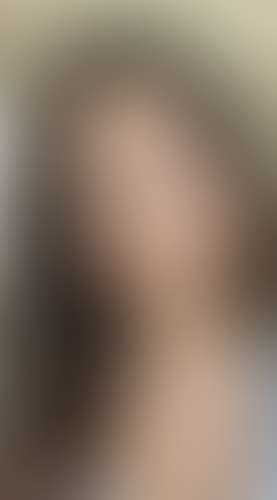 Geblurrte Content-Vorschau