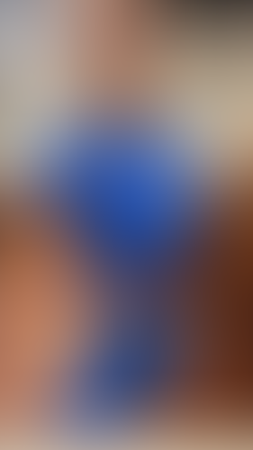 Geblurrte Content-Vorschau