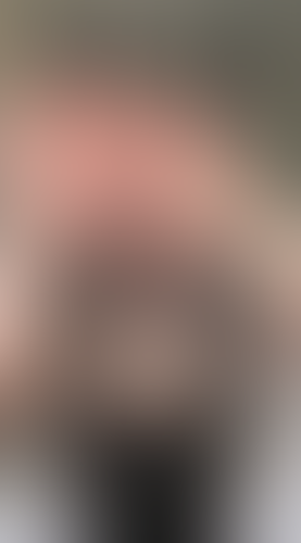 Geblurrte Content-Vorschau
