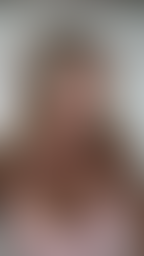 Geblurrte Content-Vorschau