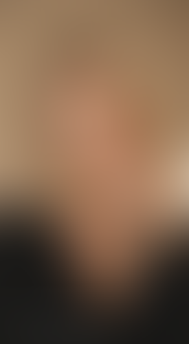 Geblurrte Content-Vorschau