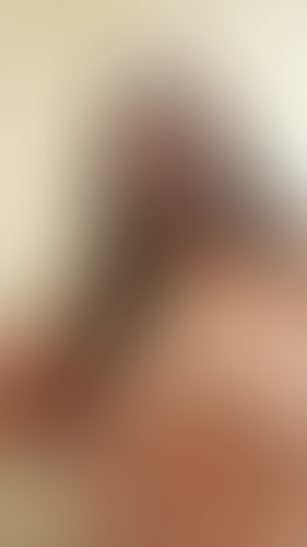Geblurrte Content-Vorschau